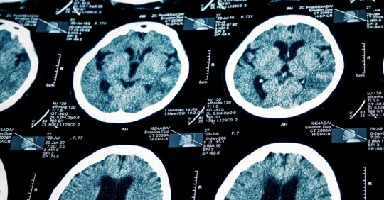 Medical pattern of human skull.