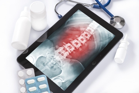 A tablet displays a spine x-ray with a red highlighted area, surrounded by medical supplies.