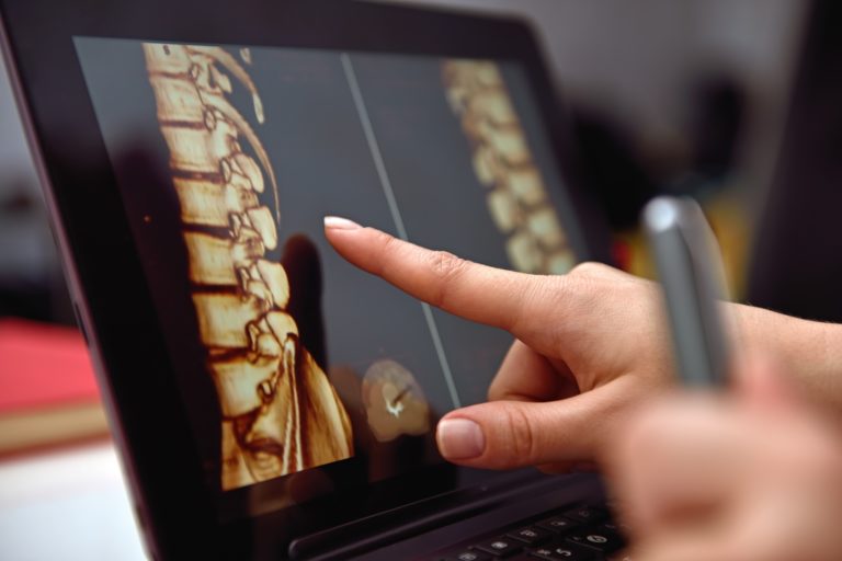 Tablet of spinal x-ray