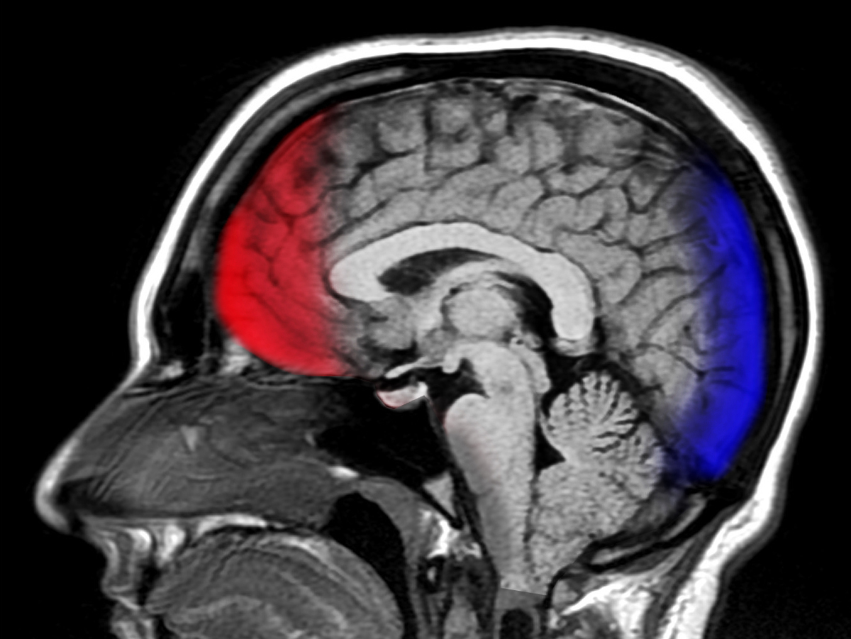 Image result for traumatic brain injury
